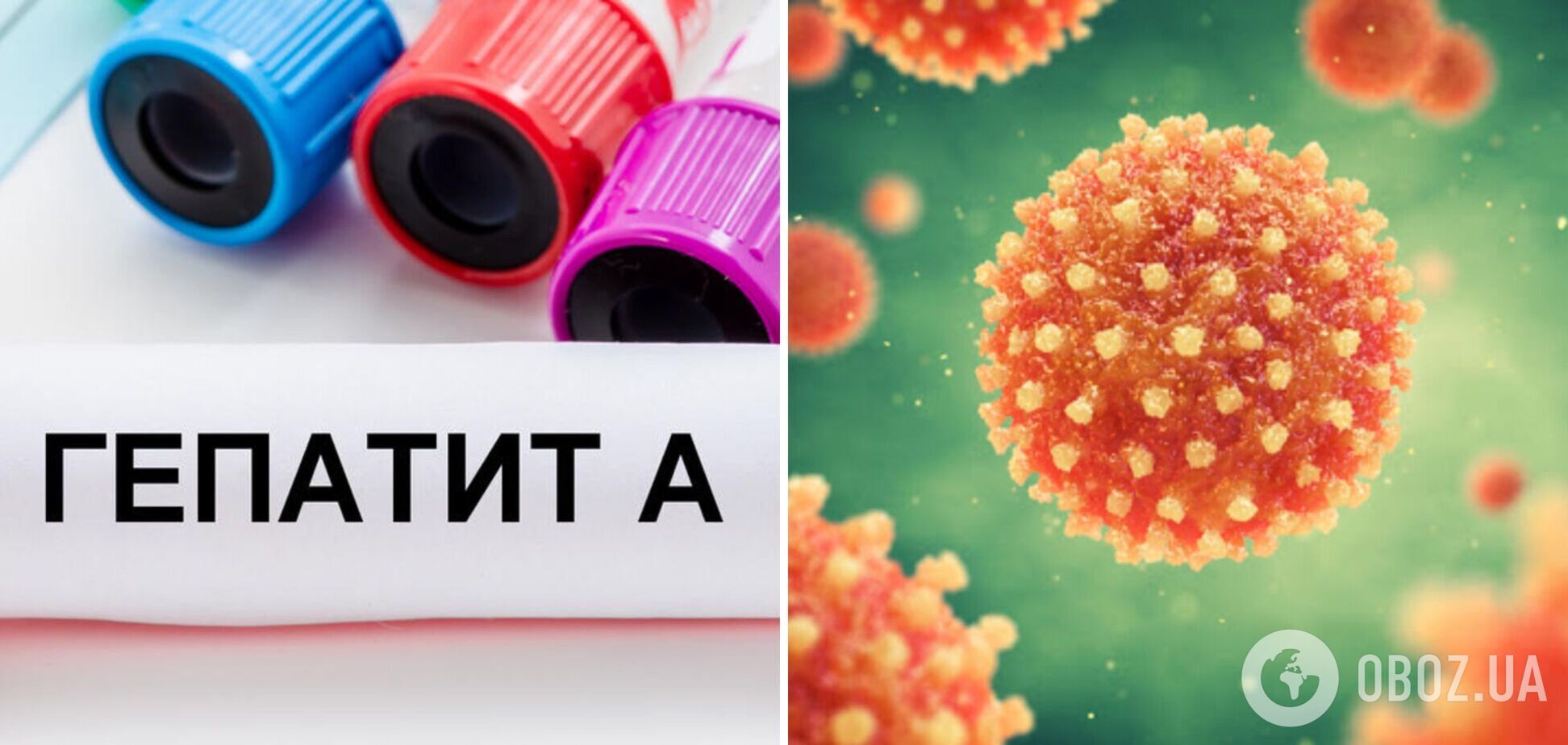 Гепатит А зафіксували вже в п'яти областях України: як вберегтися