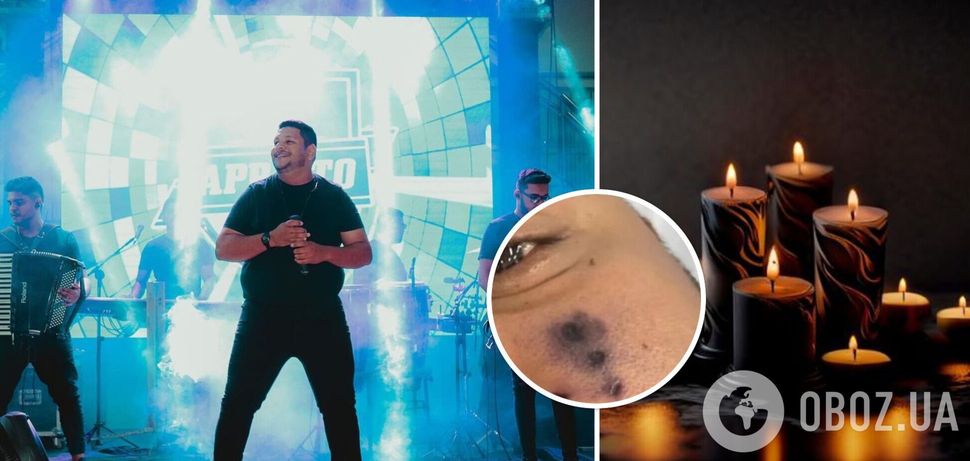 В Бразилии скончался 28-летний певец: его за лицо укусил паук. Фото