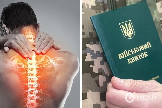 Які хвороби хребта є підставою для звільнення від мобілізації і що робити, якщо у ВЛК це не врахували: роз'яснення