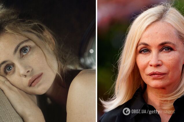 'Утиные' уже не в моде: 5 звезд, которые неудачно увеличили губы. Фото