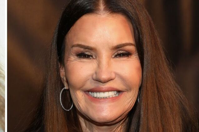 Перестаралися: 5 знаменитостей, які 'зістарили' себе ботоксом. Фото