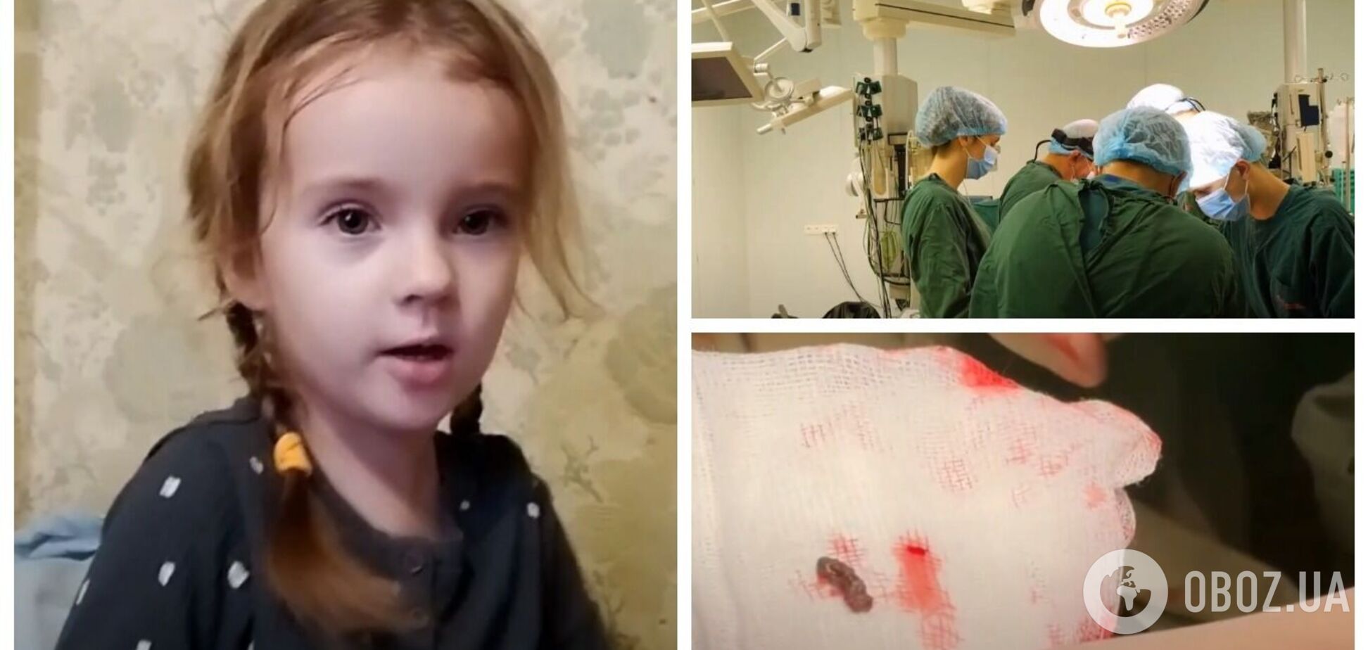 В Херсоне девочка чудом выжила после того, как ей в сердце попал обломок вражеского снаряда. Видео