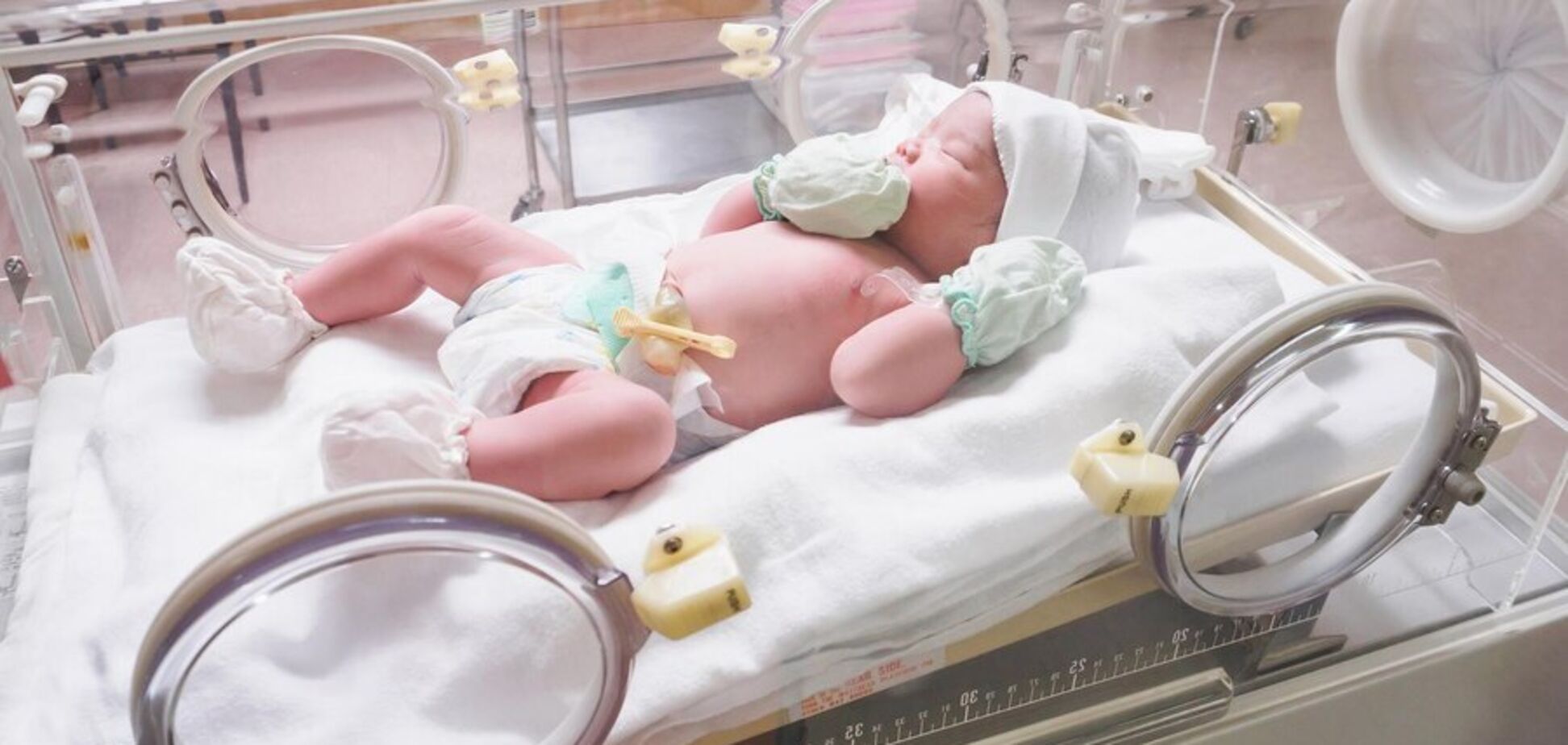Медзакупки Украины приобрели 12 инкубаторов для новорожденных в рамках UNITED24