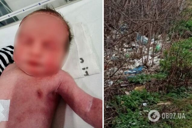 Появились данные о состоянии младенца, которого нашли на мусорнике на Полтавщине: его выбросила мать