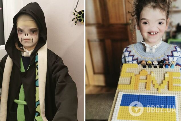 Її називали 'Волдеморт': який вигляд сьогодні має 10-річна дівчинка з Великої Британії, що народилася без носа