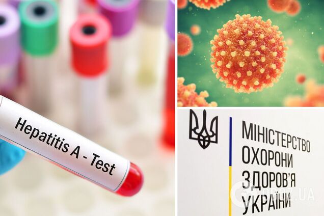 Вспышку гепатита А на Виннитчине ликвидировали: названы вероятные причины распространения