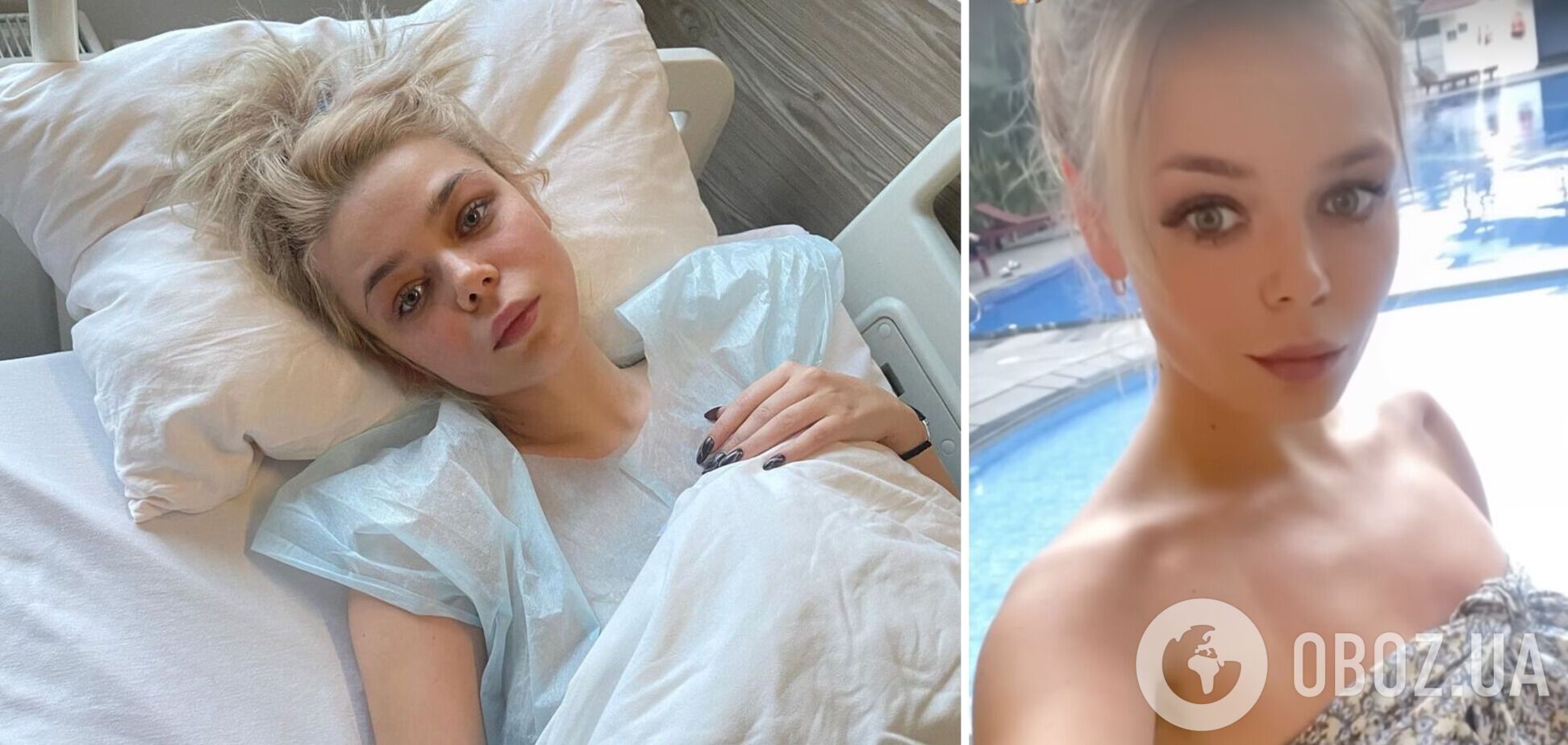 Алина Гросу сильно похудела после операции и лечения в Индии. Фото до и после