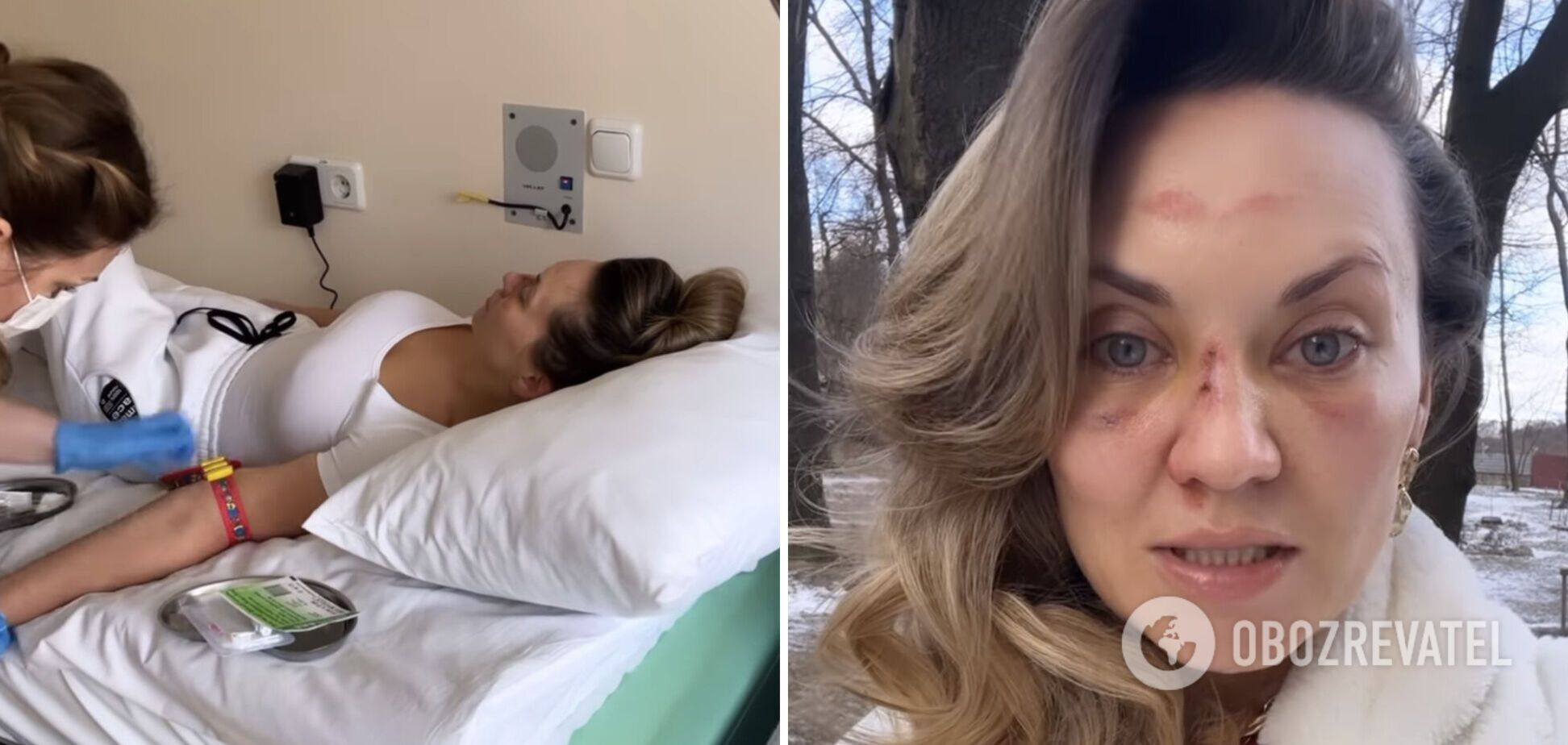 Саліванчук, яка серйозно травмувала обличчя та голову, готується до операції: буду плакати, якщо говоритиму про це