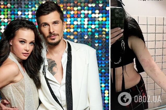 Участница 'Танцев со звездами' пожаловалась на серьезную болезнь, с которой борется 6 месяцев: врачи разводили руками