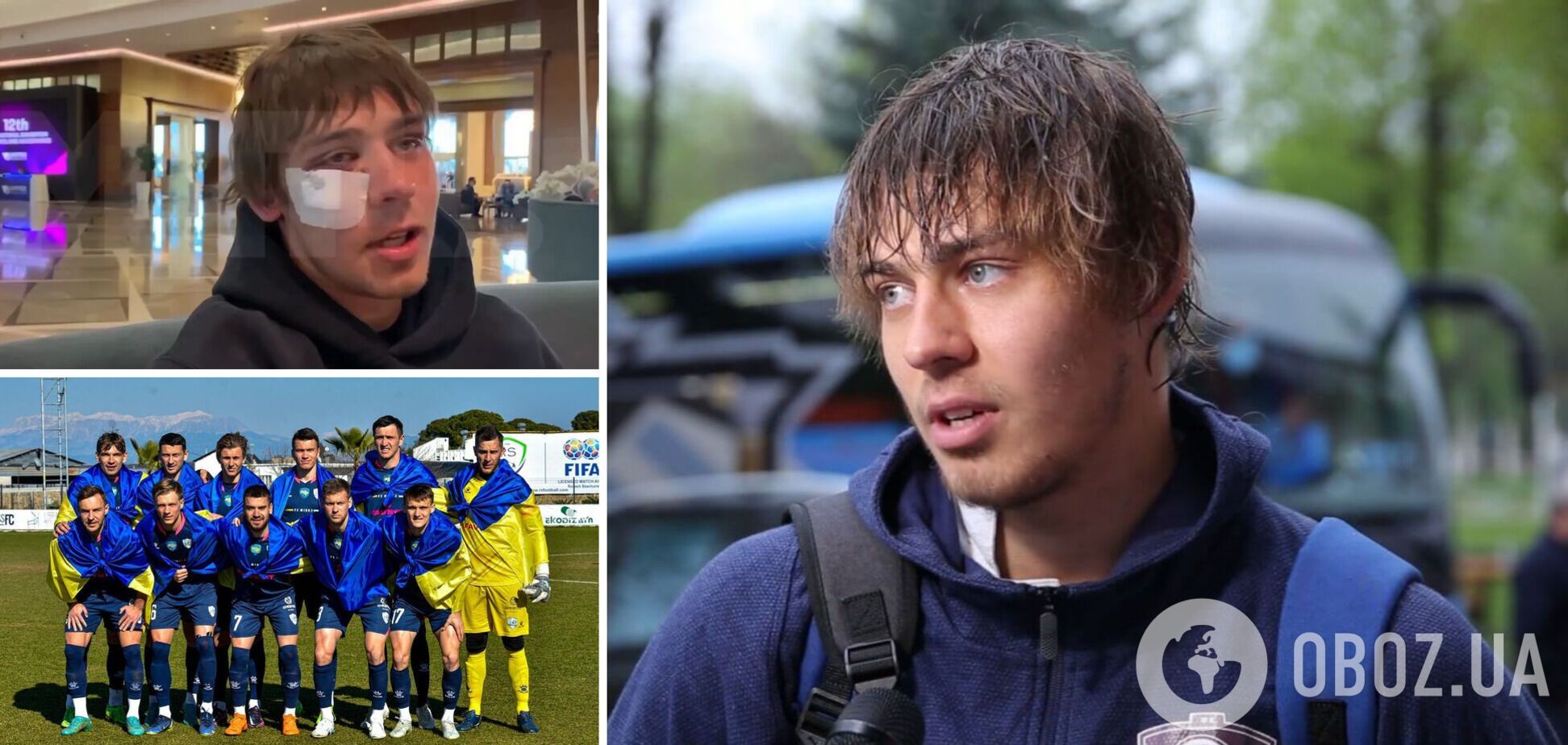 'Наваляли русским? Бред': побитый футболист 'Шинника', который кричал 'слава России', рассказал о драке с 'Минаем'