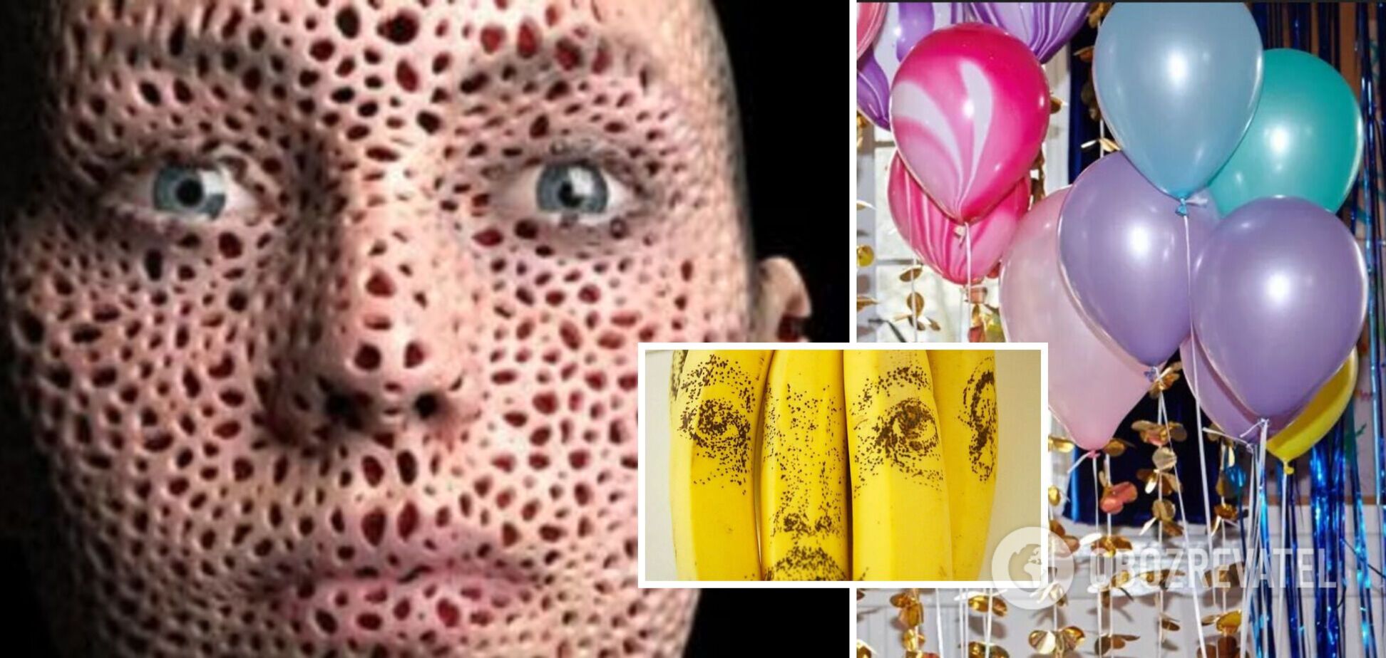 Страх бананов, длинных слов и не только: топ-10 странных фобий, которые существуют на самом деле