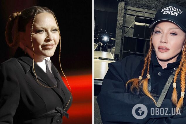 Мадонна показала, как выглядит ее лицо 'после операции'. Фото