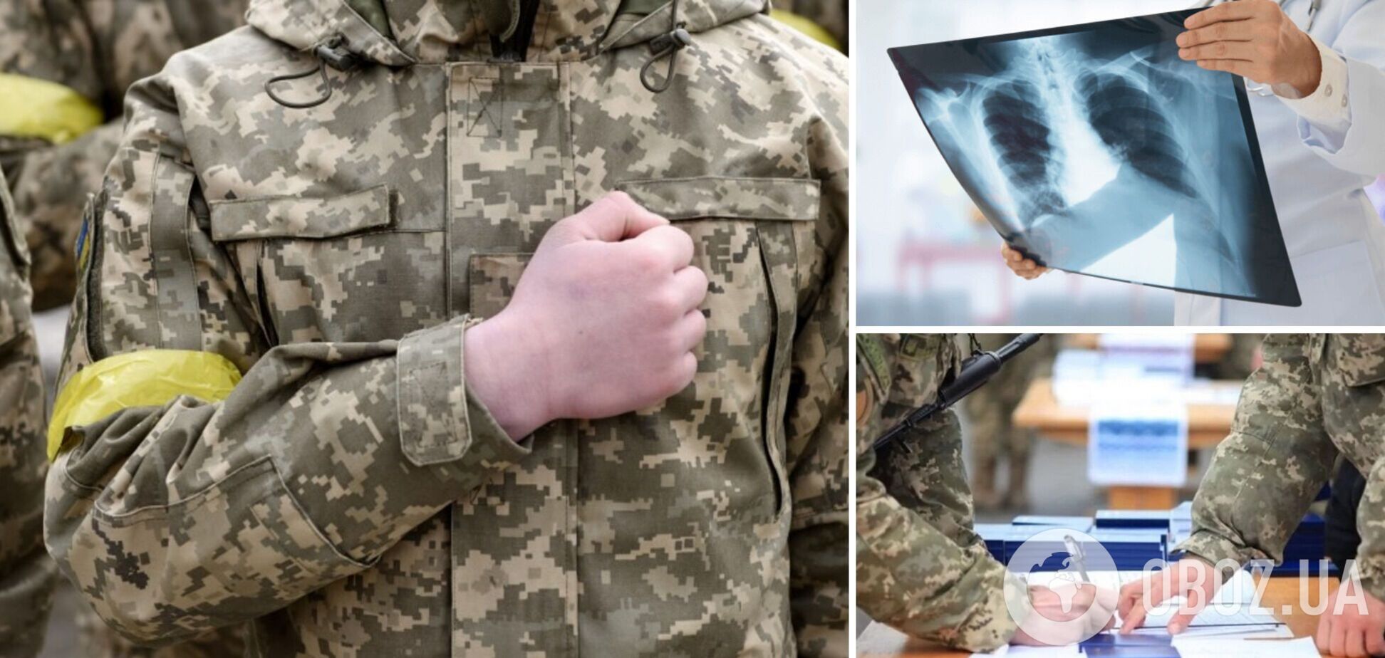 Які хвороби органів дихання є підставою для визнання непридатним до служби під час мобілізації в Україні: роз’яснення