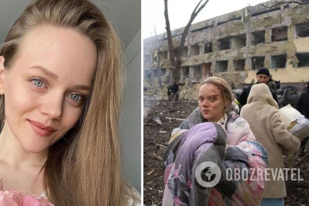 Вышемирская, фото которой облетели мир после ударов РФ по роддому в Мариуполе, из Москвы рассказывает о '8 лет бомбили Донбасс'. Фото