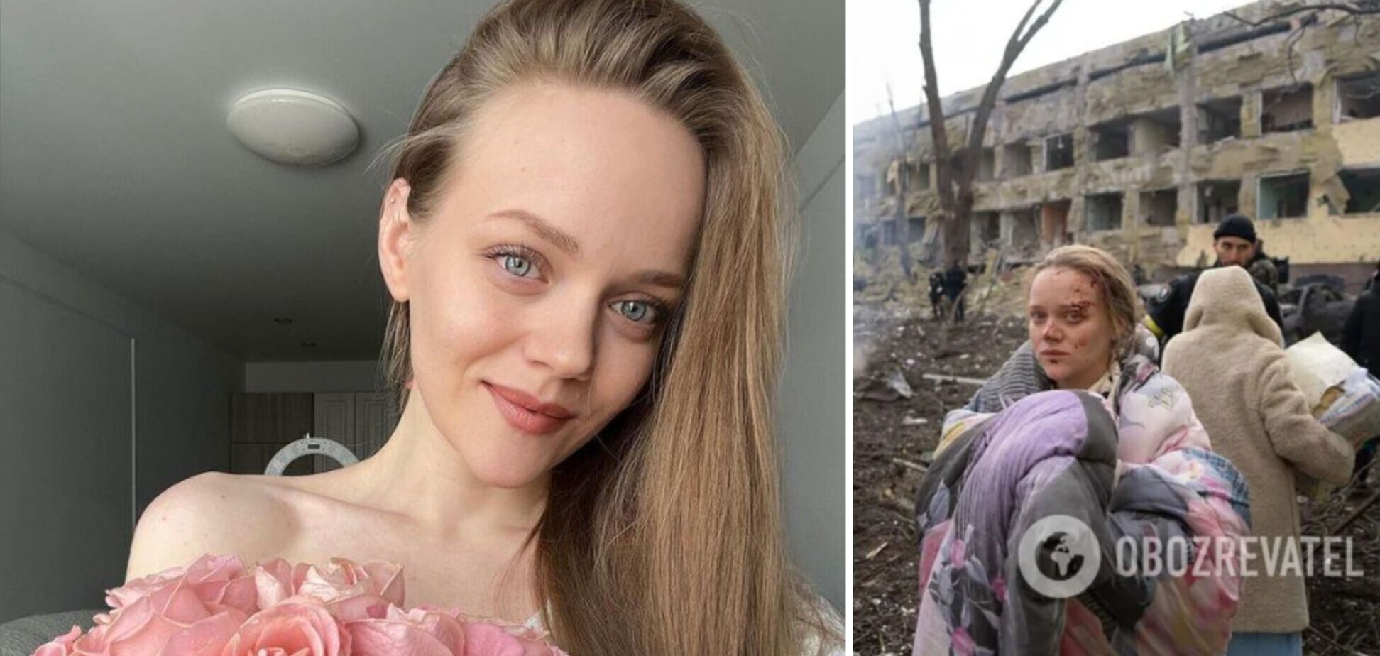 Вышемирская, фото которой облетели мир после ударов РФ по роддому в Мариуполе, из Москвы рассказывает о '8 лет бомбили Донбасс'. Фото