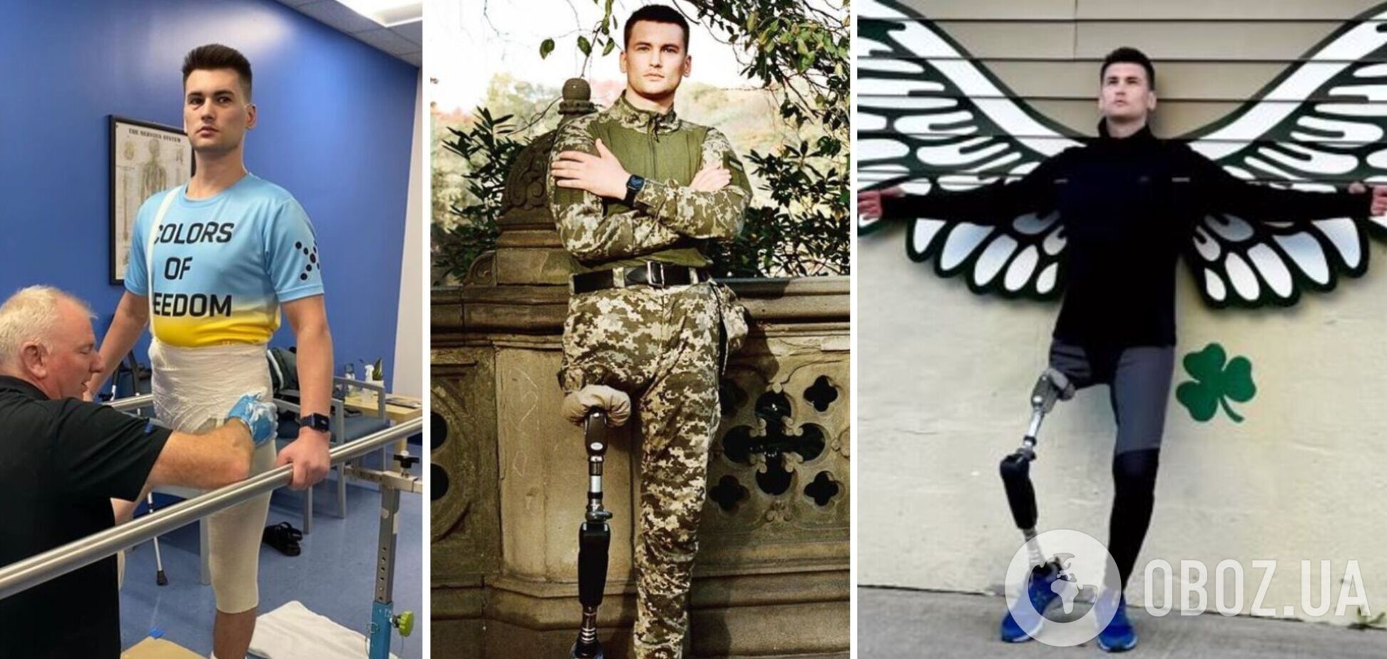 'Лікарі давали 20% на те, що я житиму': історія викладача танців Олександра Чайки, який втратив ногу на війні