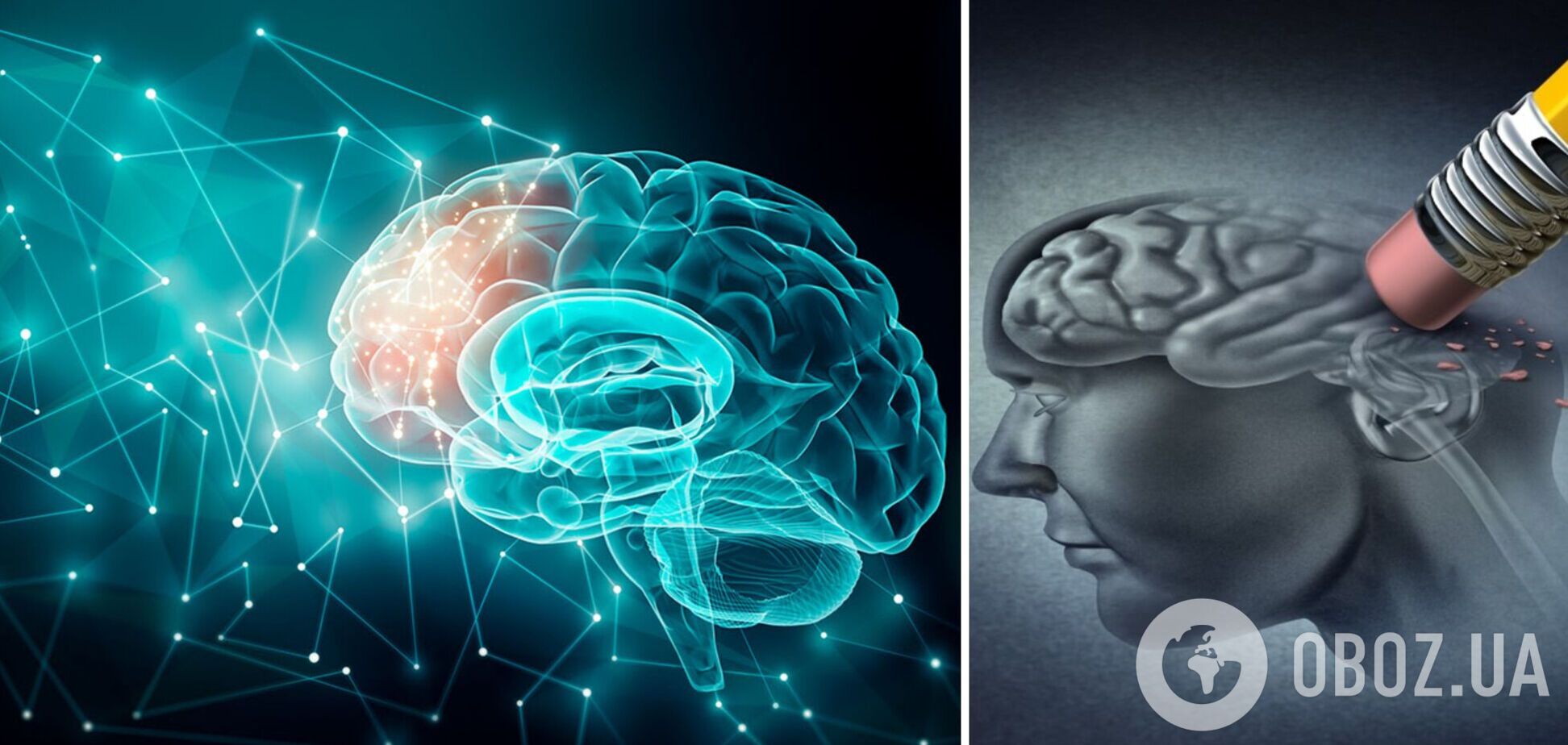 У мозку виявили раніше невідому анатомічну структуру, здатну захистити від Альцгеймера