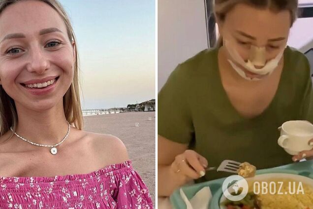 Павлик был против: Репяхова сделала ринопластику и показала первое фото после операции