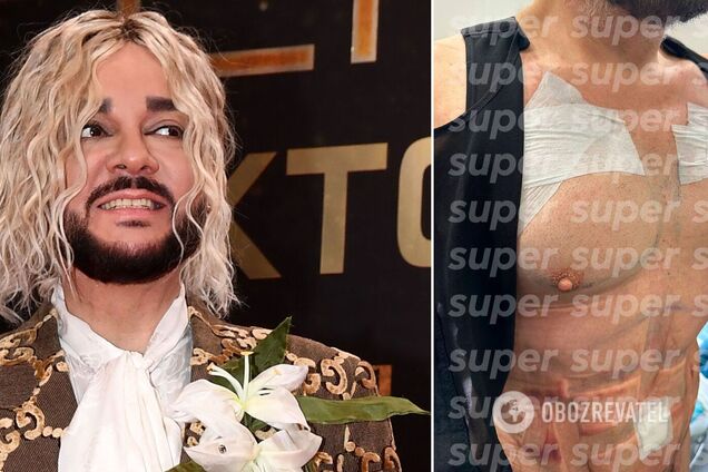 Смеются даже путинисты: в сети показали, как Киркоров нарастил себе мышцы пресса и груди с помощью пластики. Фото