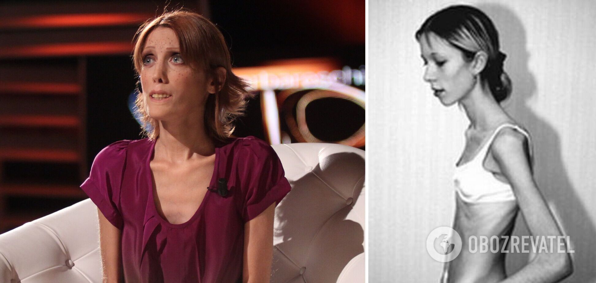 На чаше весов была их жизнь: пять знаменитостей, которые умерли от анорексии в погоне за идеальной фигурой. Фото