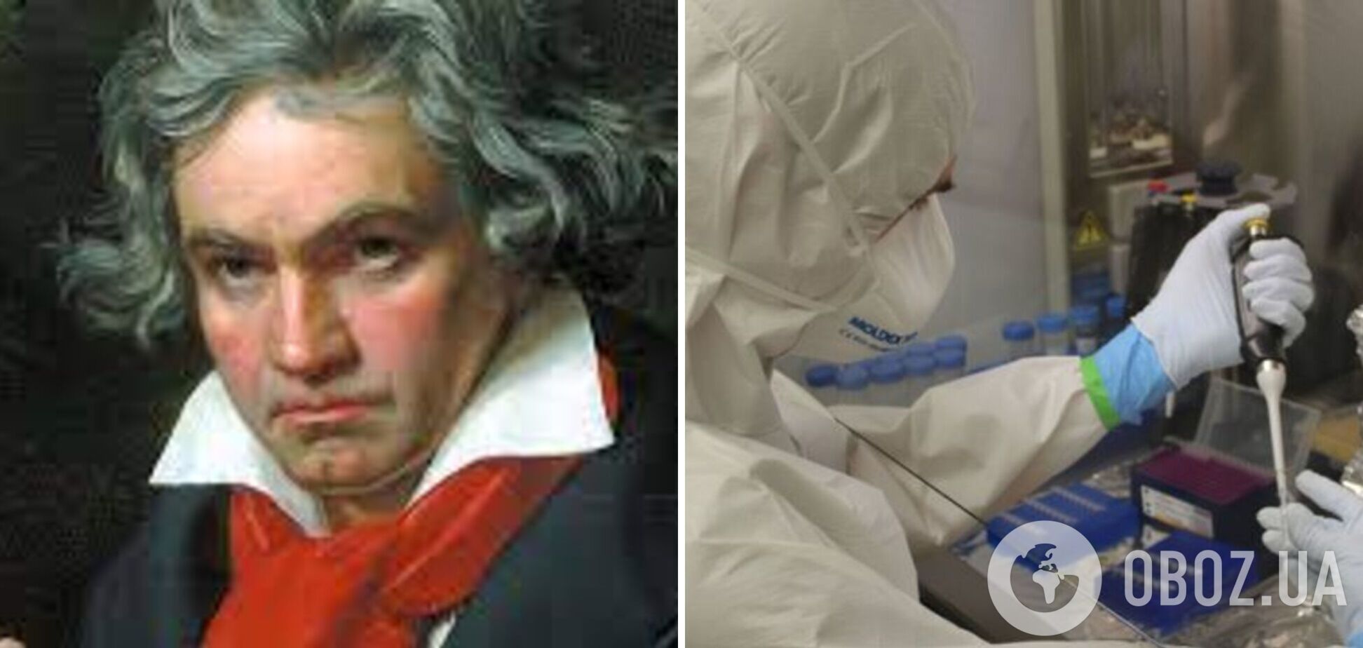 Вчені провели ДНК-аналіз волосся Бетховена і  з’ясували причину його хвороб 