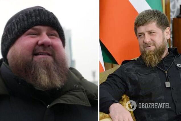 Рамзан Кадыров болен – глава Чечни имеет болезнь почек и зависимость от  стимуляторов | OBOZ.UA