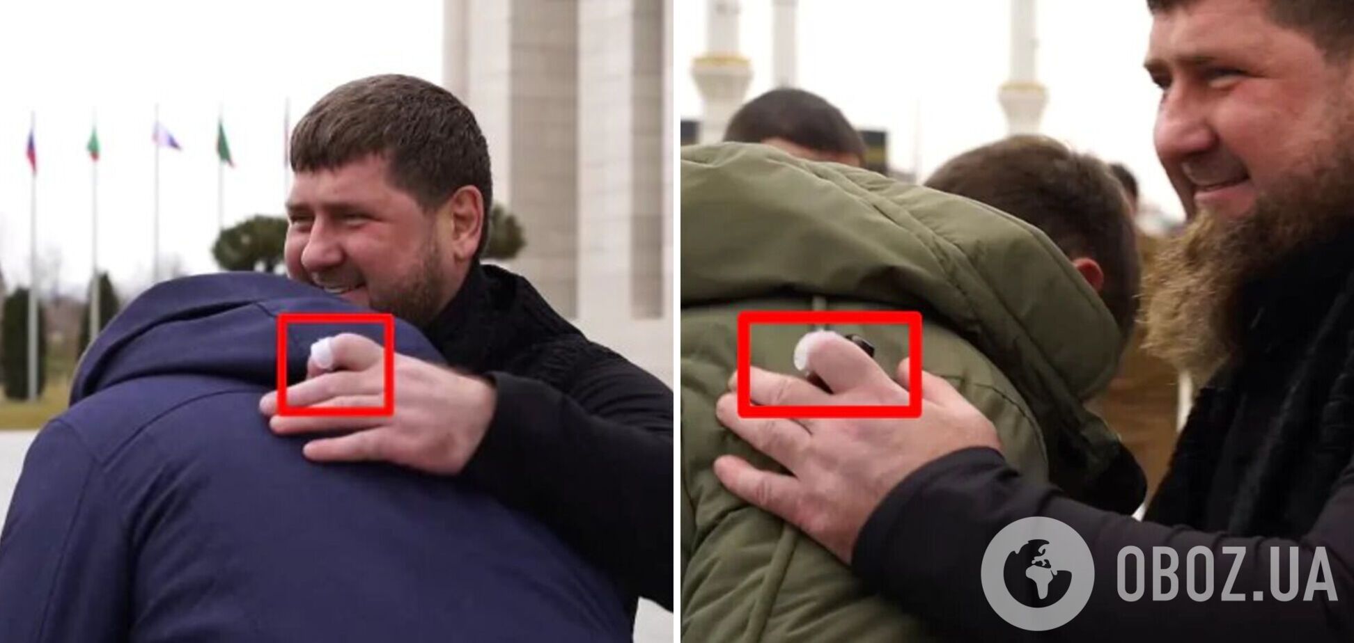 Кадыров больной – на пальце у Кадырова заметили пульсоксиметр – фото |  OBOZ.UA
