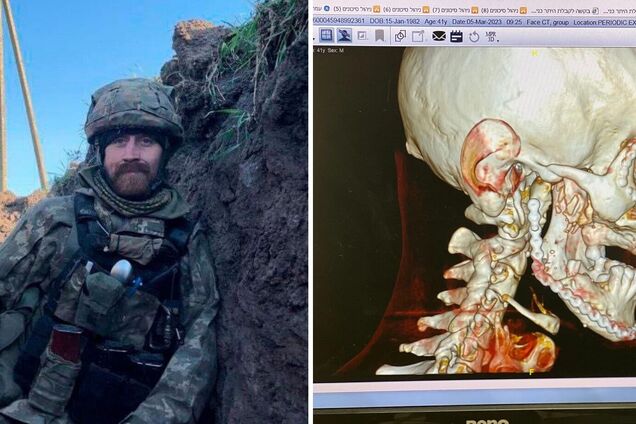 Захисник Маріуполя Діанов та 'Шахтар' організували лікування та протезування українського воїна в Ізраїлі