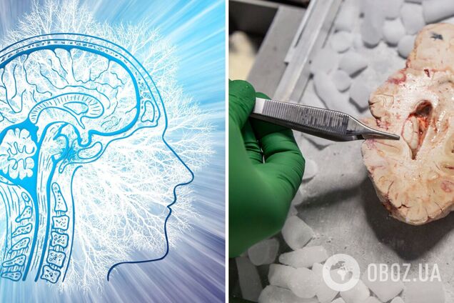 После смерти в мозгу человека просыпаются зомби-гены: что обнаружили ученые