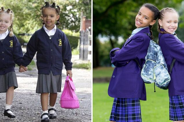 'Один випадок на мільйон': як склалася доля близнючок із різним кольором шкіри, фото яких облетіли світ