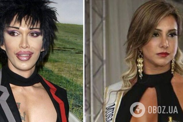 Погоня за красотой стоила жизни: пять звезд, которых убила неудачная пластика. Фото