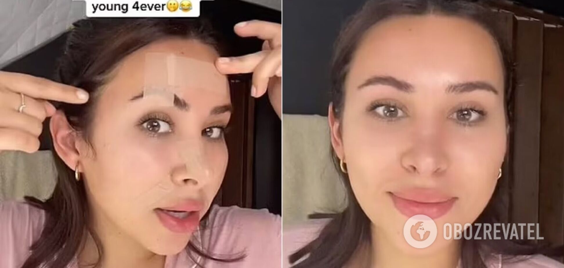 Спасение от морщин? Женщина показала доступную всем альтернативу ботоксу и покорила сеть: видео стало вирусным