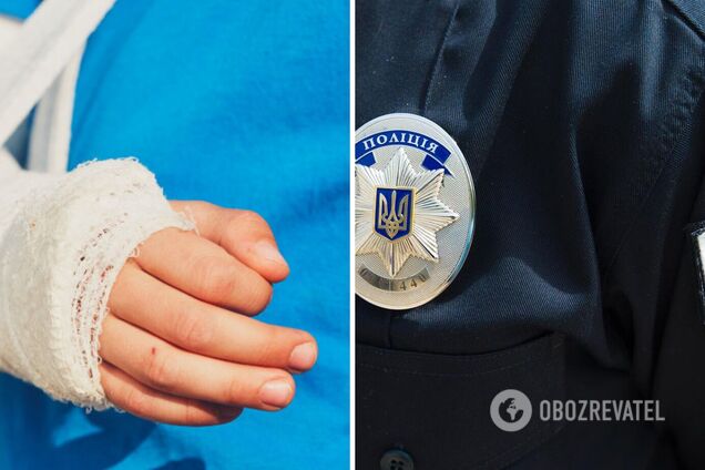 На Житомирщине мать сломала сыну руку из-за разных политических взглядов: делом занялась полиция