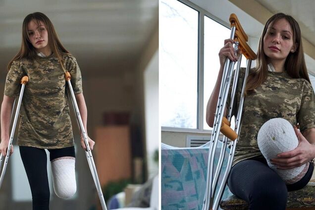 'Стала символом незламності': у мережі розповіли про юну захисницю України, яка втратила ногу на війні, але не здалася