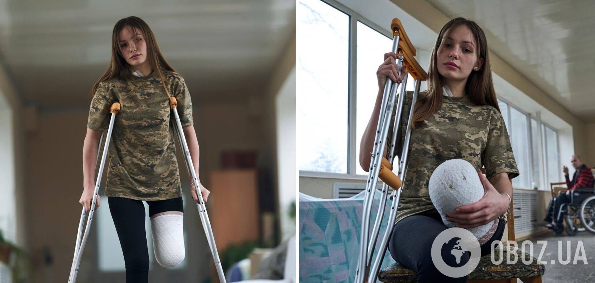 'Стала символом несокрушимости': в сети рассказали о юной защитнице Украины, которая потеряла ногу на войне, но не сдалась