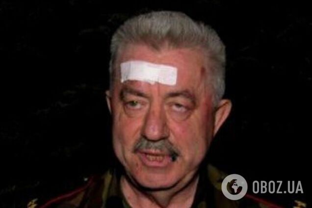 Во время удара по Луганску ранило депутата Госдумы РФ Водолацкого. Видео