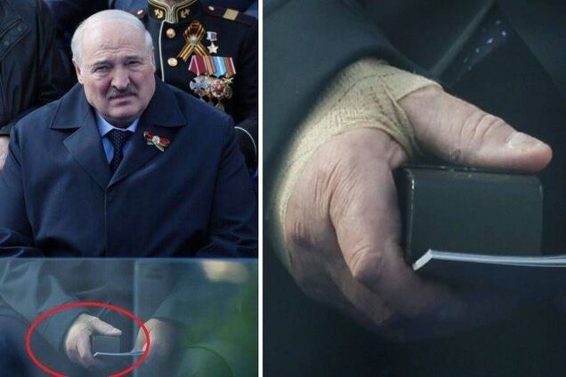 У Лукашенка виникли серйозні проблеми зі здоров'ям: у мережу просочилися деталі
