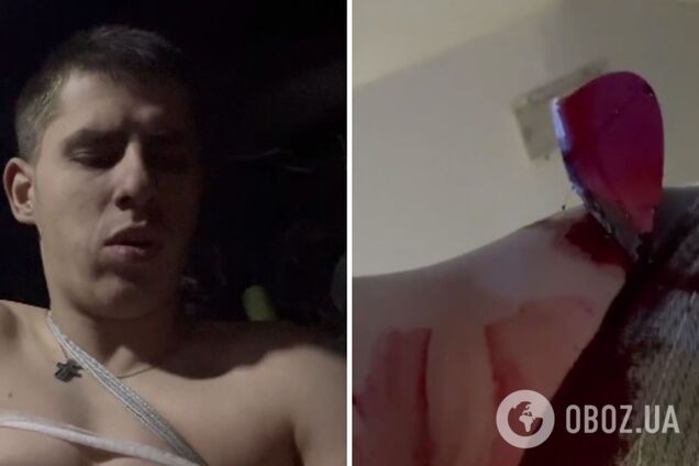 Награжденный Залужным воин с позывным 'Хищник' получил ранение на фронте: ранее он с 5 метров уничтожил оккупантов и БМП-2