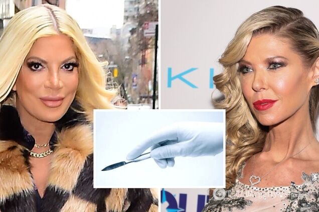 Все пошло не так! Шесть звезд, карьеру которых разрушила неудачная пластика. Фото до и после