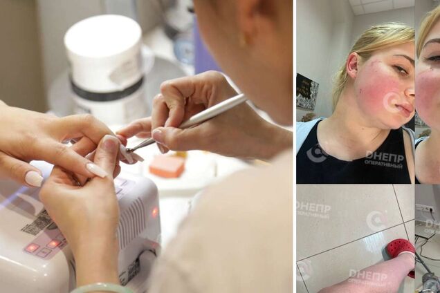 Были 'претензии': в Днепре клиентка избила мастера маникюра, делом занялась полиция. Фото