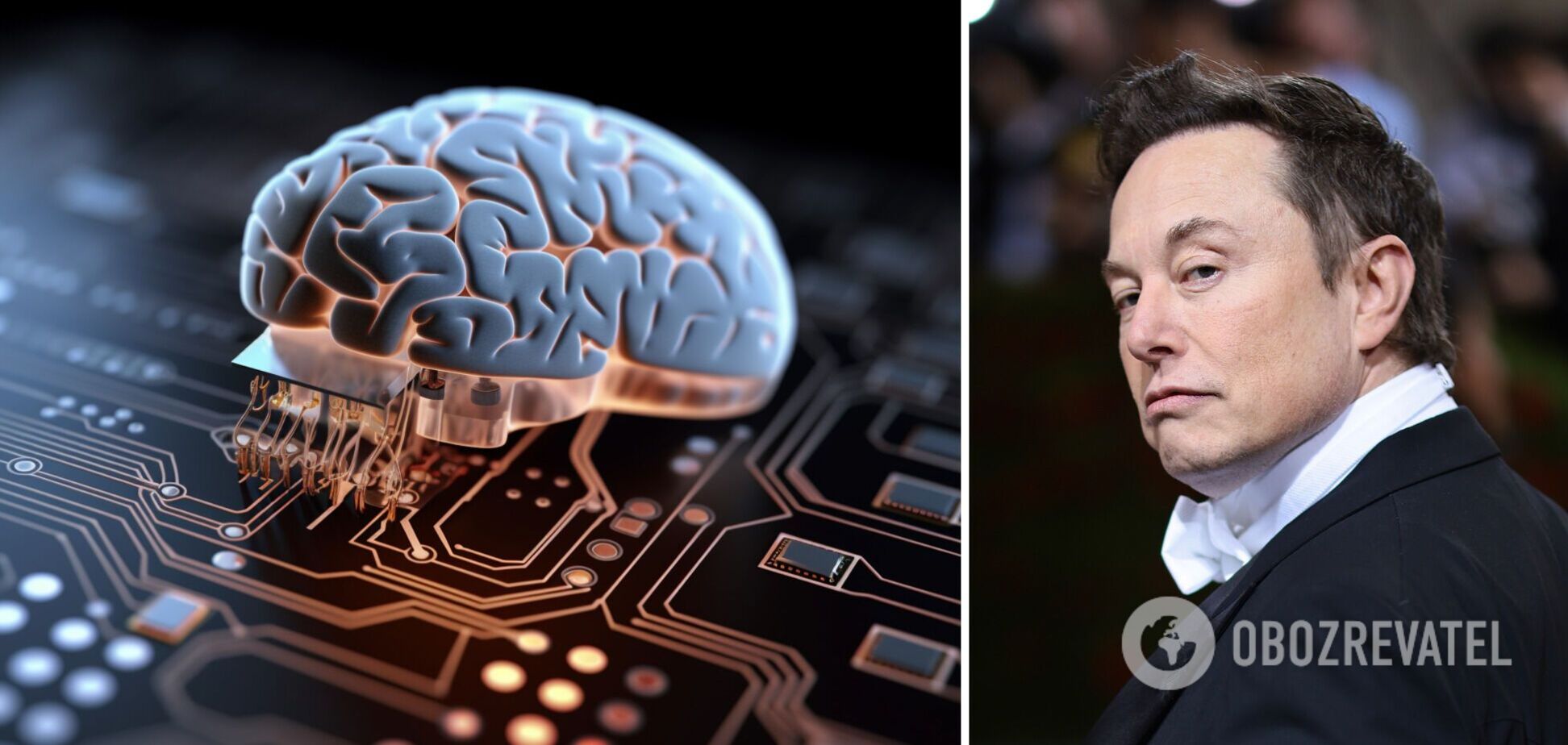 Neuralink Ілона Маска дозволили вживити чип у мозок людини: попередні тести вбили понад 1500 тварин