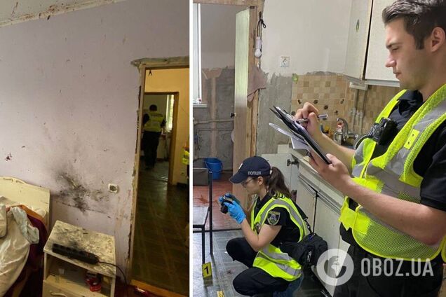 Відірвало кисть: на Київщині чоловік отримав важкі травми, намагаючись розібрати знайдений запал для снаряда. Фото і відео