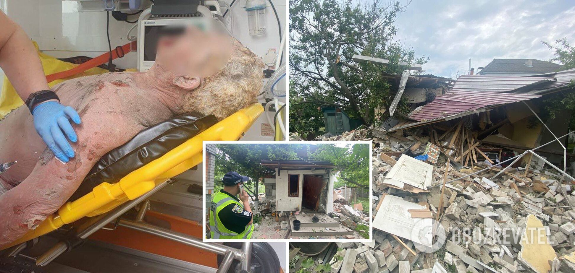 Зажег спичку – и раздался взрыв: в Буче из-за газового баллона разрушен дом, пострадал мужчина. Фото