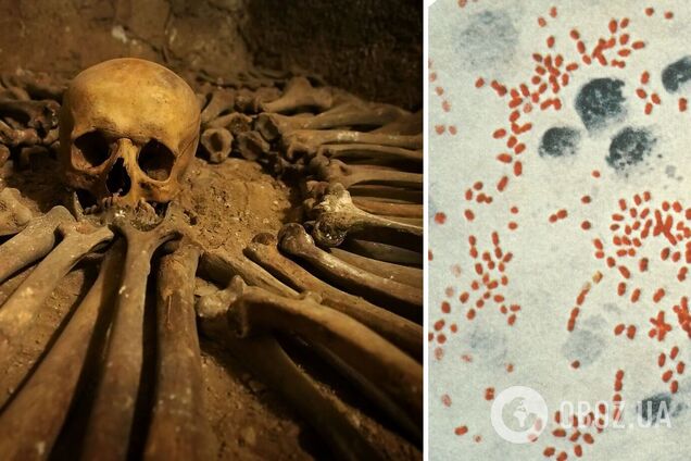 У Британії виявили ДНК чуми, яка лютувала 4000 років тому