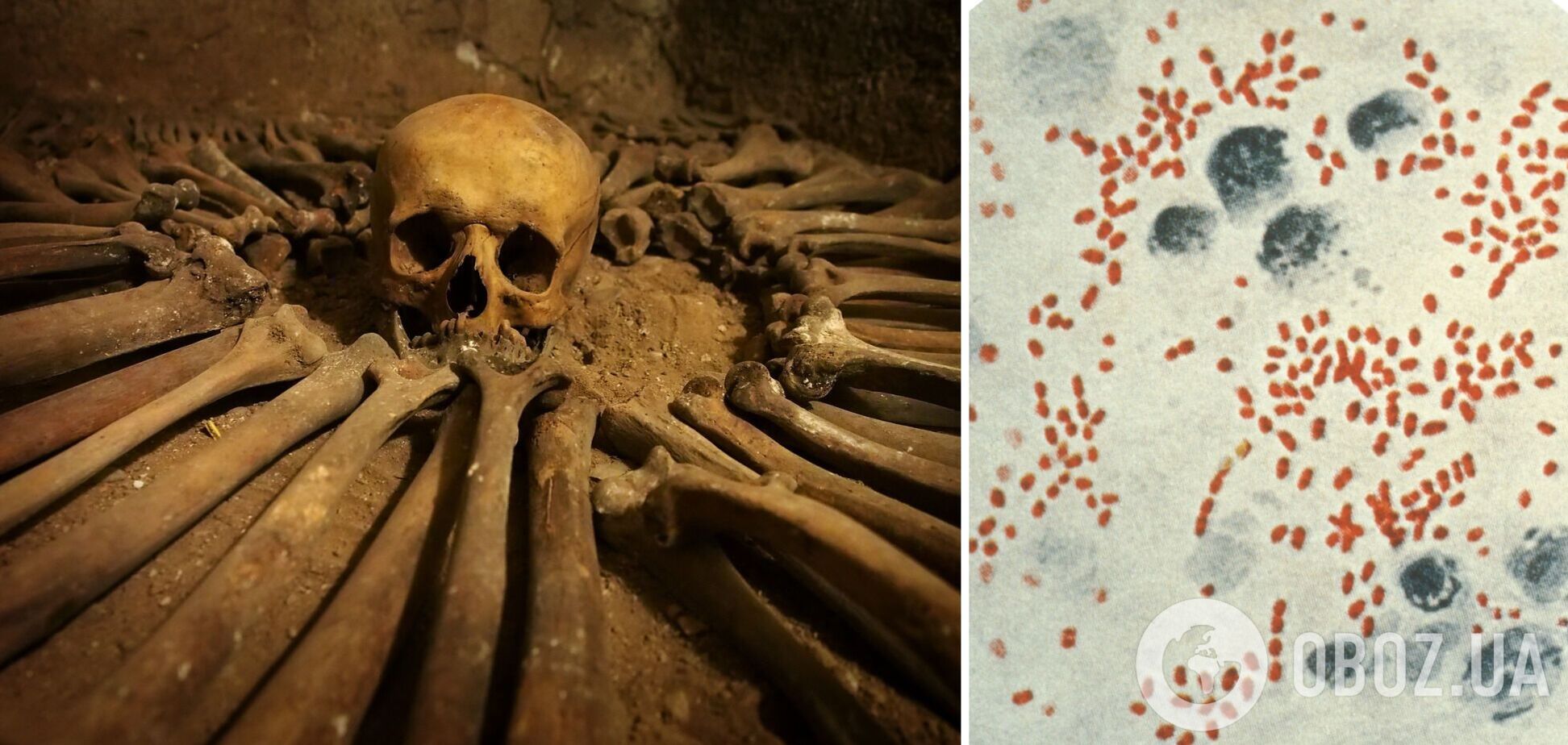 В Британии обнаружили ДНК чумы, свирепствовавшей 4000 лет назад
