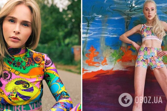 Заплатила $160 тыс., чтобы ей сломали кости: как выглядит модель, которая решилась на безумный шаг ради красоты. Фото