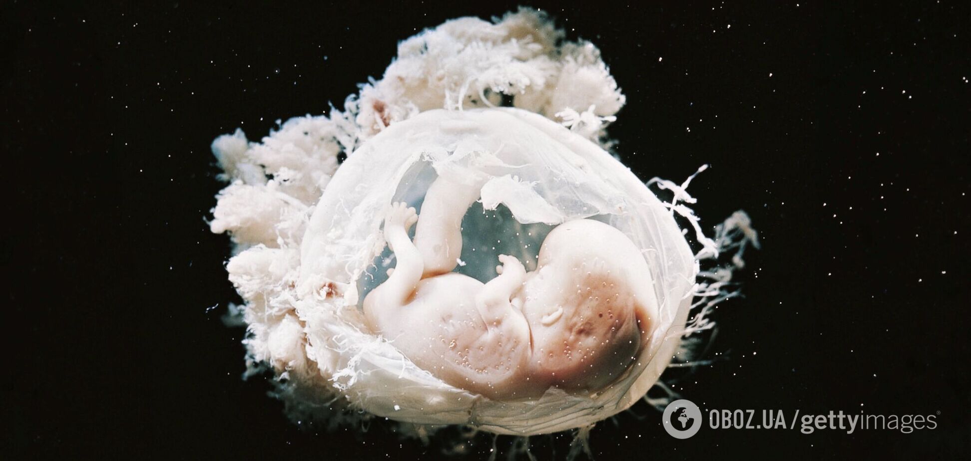 Вчені вперше в історії створили повністю синтетичні людські ембріони