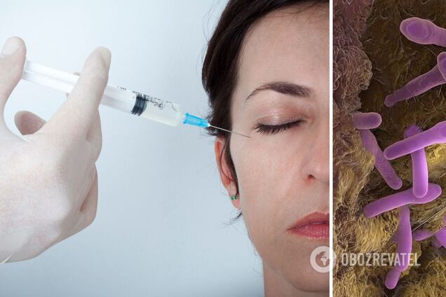 Уколи краси можуть бути смертельними: вчені виявили проникнення ботоксу в мозок