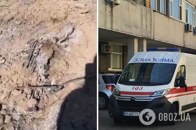 Потерпілий отримав опіки, випалюючи метал з кабелів