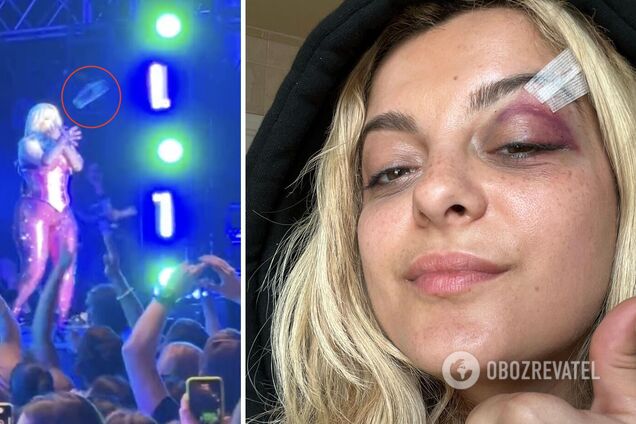 Фанат швырнул телефон в голову популярной певице и свалил ее с ног: его задержали, а звезда показала последствия на лице